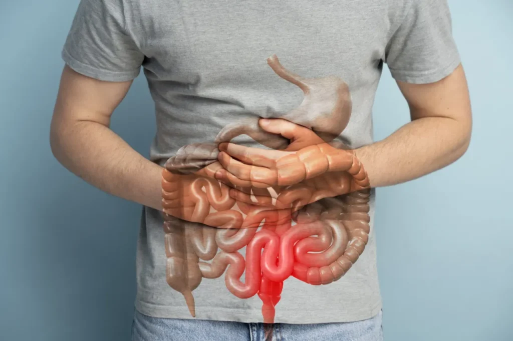 intestino